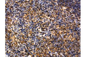 MUM1 Antibody at 1/100 staining Mouse spleen tissue by IHC-P.