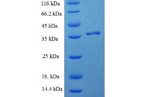 SDS-PAGE (SDS) image for Immature Colon Carcinoma Transcript 1 (ICT1) (AA 30-206) protein (His-SUMO Tag) (ABIN4976147) (ICT1 Protein (AA 30-206) (His-SUMO Tag))