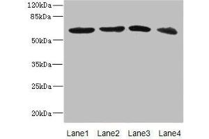 Western blot All lanes: RGS14 antibody at 3.