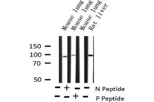 Western blot analysis of Phospho-STAT5B (Ser731) expression in various lysates (STAT5B 抗体  (pSer731))
