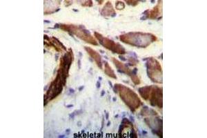 Immunohistochemistry (IHC) image for anti-Filamin A, alpha (FLNA) antibody (ABIN3003482) (Filamin A 抗体)