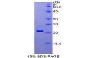 SDS-PAGE analysis of Human Interferon alpha 4 Protein. (IFNA4 蛋白)
