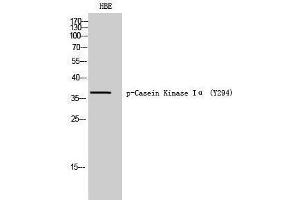 Western Blotting (WB) image for anti-Casein Kinase 1, alpha 1 (CSNK1A1) (pTyr294) antibody (ABIN3182662) (CSNK1A1 抗体  (pTyr294))