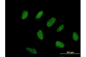 Immunofluorescence of purified MaxPab antibody to FLJ38288 on HeLa cell.
