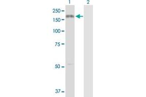 Western Blotting (WB) image for anti-Collagen, Type III, alpha 1 (COL3A1) (AA 1-1163) antibody (ABIN514513)