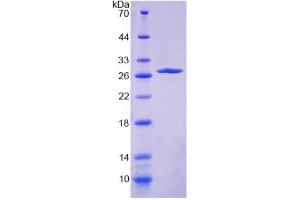 SDS-PAGE (SDS) image for Collagen, Type IV, alpha 4 (Col4A4) (AA 1469-1690) protein (His tag) (ABIN6239048)