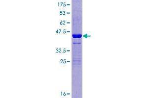 Image no. 1 for Ataxin 7-Like 1 (ATXN7L1) (AA 1-146) protein (GST tag) (ABIN1346199) (ATXN7L1 Protein (AA 1-146) (GST tag))
