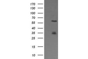 Image no. 1 for anti-Polo-Like Kinase 1 (PLK1) antibody (ABIN1500284) (PLK1 抗体)