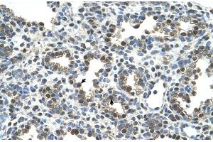 Immunohistochemistry (IHC) image for anti-Osteoactivin (GPNMB) (N-Term) antibody (ABIN2781893)