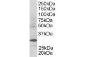 Image no. 2 for anti-F-Box and WD Repeat Domain Containing 2 (FBXW2) (C-Term) antibody (ABIN374352) (FBXW2 抗体  (C-Term))