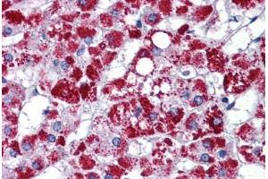 Human Adrenal: Formalin-Fixed, Paraffin-Embedded (FFPE) (ARL8A 抗体  (AA 72-121))