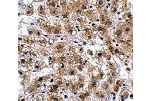 Immunohistochemistry of AFAP1L2 in human liver tissue with AFAP1L2 polyclonal antibody  at 2. (AFAP1L2 抗体)