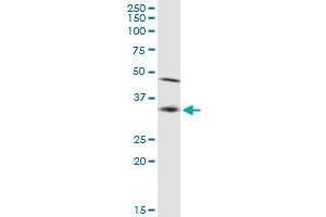 Western Blotting (WB) image for anti-Signal Sequence Receptor, alpha (SSR1) (AA 1-286) antibody (ABIN520503)