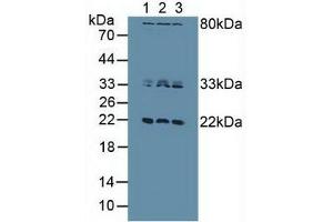 Western blot analysis of (1) Human HeLa cells, (2) Human Jurkat Cells and (3) Human MCF7 Cells. (Dual Specificity Phosphatase 3 (DUSP3) (AA 2-185) 抗体)