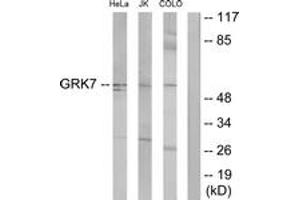 Western blot analysis of extracts from COLO205/Jurkat/HeLa cells, using GRK7 Antibody. (GRK7 抗体  (AA 371-420))