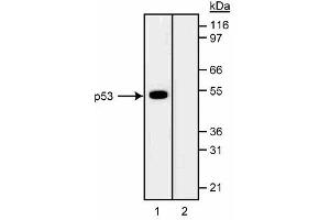 Western blot analysis of p53 in CEM human leukemia cell lysates.