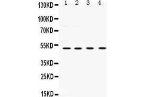 Western Blotting (WB) image for anti-Ubiquitin-Conjugating Enzyme E2Q Family Member 2 (UBE2Q2) (AA 83-123), (N-Term) antibody (ABIN3043953) (UBE2Q2 抗体  (N-Term))