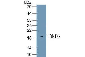 Detection of Recombinant KISS1, Human using Polyclonal Antibody to Kisspeptin 1 (KISS1) (KISS1 抗体  (AA 20-138))