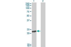 Western Blot analysis of RCV1 expression in transfected 293T cell line by RCV1 monoclonal antibody (M13), clone 1B9. (Recoverin 抗体  (AA 101-199))
