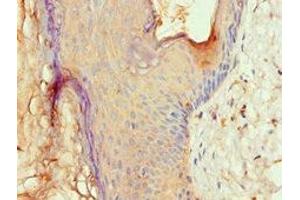 Immunohistochemistry of paraffin-embedded human skin tissue using ABIN7144532 at dilution of 1:100 (ALOX15B 抗体  (AA 1-200))