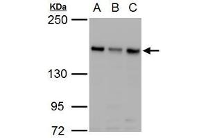 WB Image ROCK2 antibody detects ROCK2 protein by western blot analysis. (ROCK2 抗体)
