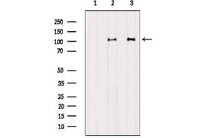 Western blot analysis of extracts from various samples, using DDX58  Antibody. (DDX58 抗体  (N-Term))