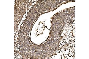 IHC analysis of PARK7/DJ1 using anti-PARK7/DJ1 antibody (ABIN7600468). (PARK7/DJ1 抗体  (AA 2-189))