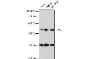 Western blot analysis of extracts of various cell lines, using ASL antibody (ABIN6127448, ABIN6137201, ABIN6137202 and ABIN6221972) at 1:1000 dilution. (ASL 抗体  (AA 1-300))