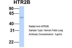 Host:  Rabbit  Target Name:  HTR2B  Sample Type:  Human Fetal Lung  Antibody Dilution:  1. (Serotonin Receptor 2B 抗体  (N-Term))