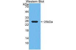 Western blot analysis of the recombinant protein. (Growth Hormone 1 抗体  (AA 28-216))