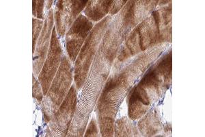 ABIN6266912 at 1/100 staining human skeletal muscle tissue sections by IHC-P.