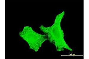 Immunofluorescence of monoclonal antibody to TUBA4A on HeLa cell. (TUBA4A 抗体  (AA 1-448))