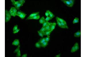 Immunofluorescence staining of HepG2 cells with ABIN7168164 at 1:266, counter-stained with DAPI. (LAS1L 抗体  (AA 490-565))