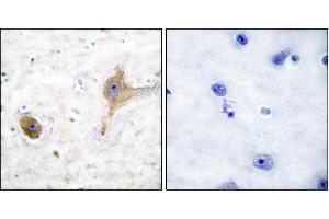 Immunohistochemical analysis of paraffin-embedded human brain tissue using GABA B Receptor antibody. (GABA B Receptor 抗体)