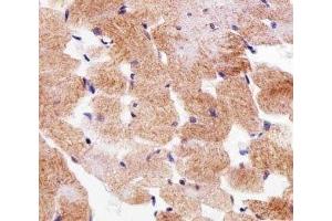 Immunohistochemistry (IHC) image for anti-Succinate Dehydrogenase Complex, Subunit A, Flavoprotein (Fp) (SDHA) (AA 577-605) antibody (ABIN3032759)