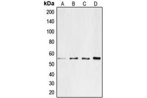 Western blot analysis of CD4 expression in Jurkat (A), SP2/0 (B), PC12 (C), H9C2 (D) whole cell lysates. (CD4 抗体  (C-Term))