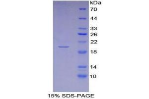 SDS-PAGE analysis of Mouse Interferon alpha 4 Protein. (IFNA4 蛋白)