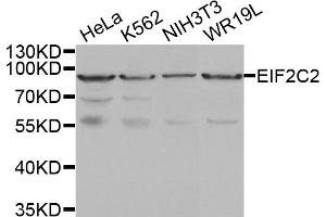 Western Blotting (WB) image for anti-Argonaute 2 (AGO2) antibody (ABIN1877052) (AGO2 抗体)
