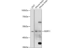Western blot analysis of extracts of various cell lines, using IGSF11 antibody (ABIN7267849) at 1:1000 dilution. (IGSF11 抗体  (AA 80-200))