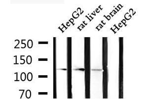 Western blot analysis of extracts from HepG2, rat liver and rat brain, using CLIP2 Antibody. (CLIP2 抗体  (C-Term))