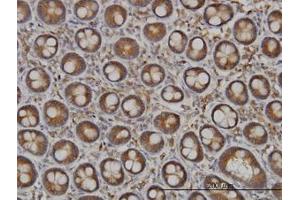Image no. 1 for anti-N-Deacetylase/N-Sulfotransferase (Heparan Glucosaminyl) 1 (NDST1) (AA 38-137) antibody (ABIN598755) (NDST1 抗体  (AA 38-137))