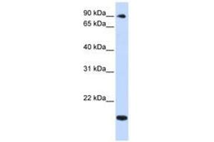 Image no. 1 for anti-TSR1, 20S rRNA Accumulation, Homolog (TSR1) (AA 648-697) antibody (ABIN6740961) (TSR1 抗体  (AA 648-697))