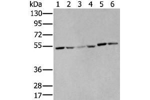 Western Blotting (WB) image for anti-Matrix Metallopeptidase 1 (Interstitial Collagenase) (MMP1) antibody (ABIN2427602) (MMP1 抗体)