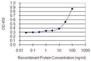 Detection limit for recombinant GST tagged MYO1E is 0. (MYO1E 抗体  (AA 918-1014))
