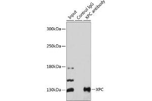 Immunoprecipitation analysis of 200 μg extracts of 293T cells using 3 μg XPC antibody ( ABIN6128932, ABIN6150295, ABIN6150296 and ABIN6224381). (XPC 抗体  (AA 700-940))