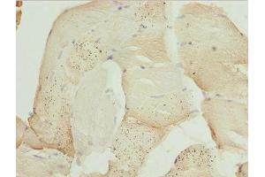Immunohistochemistry of paraffin-embedded human skeletal muscle tissue using ABIN7175976 at dilution of 1:100 (ZBTB25 抗体  (AA 266-435))