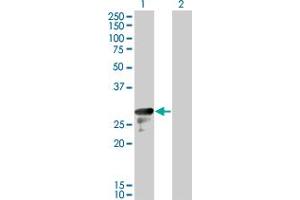 Western Blot analysis of DENR expression in transfected 293T cell line by DENR monoclonal antibody (M01), clone 1H3. (Density Regulated Protein 抗体  (AA 1-81))