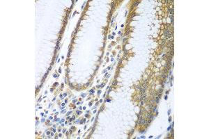 Immunohistochemistry of paraffin-embedded human stomach using FUT6 antibody at dilution of 1:100 (40x lens). (FUT6 抗体)