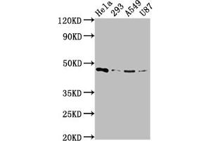 Western Blot Positive WB detected in: Hela whole cell lysate, 293 whole cell lysate, A549 whole cell lysate, U87 whole cell lysate All lanes: MAP2K1 antibody at 1:2000 Secondary Goat polyclonal to rabbit IgG at 1/50000 dilution Predicted band size: 44, 41 kDa Observed band size: 44 kDa (Recombinant MEK1 抗体)