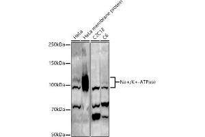 Western blot analysis of extracts of various cell lines, using Na+/K+-ATPase antibody (ABIN6133568, ABIN6137299, ABIN6137301 and ABIN6223860) at 1:500 dilution. (ATP1A1 抗体  (AA 1-100))